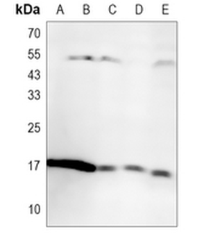 IBA1 Rabbit Monoclonal Antibody
