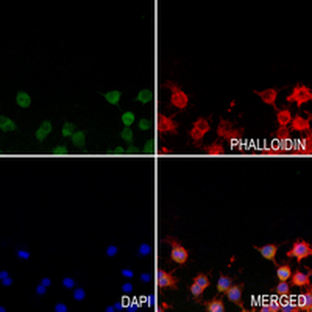 IBA1 Rabbit Monoclonal Antibody