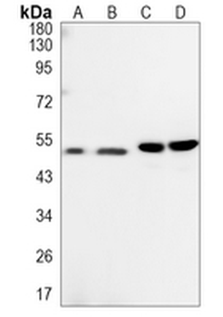GFAP Rabbit Monoclonal Antibody