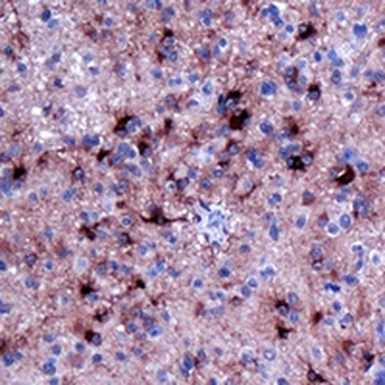 GFAP Rabbit Monoclonal Antibody