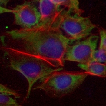 GFAP Rabbit Monoclonal Antibody