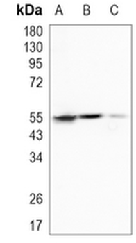 ALDH1A1 Rabbit Monoclonal Antibody