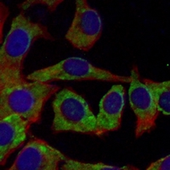 ALDH1A1 Rabbit Monoclonal Antibody