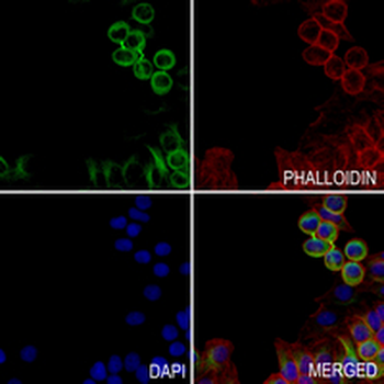 GLUR2/3 Rabbit Monoclonal Antibody