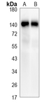 TRK A/B/C Rabbit Monoclonal Antibody