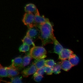 Tyrosine Hydroxylase Rabbit Monoclonal Antibody