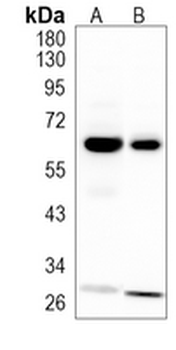LGI1 Rabbit Monoclonal Antibody