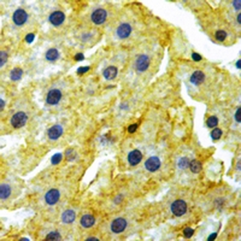 LGI1 Rabbit Monoclonal Antibody
