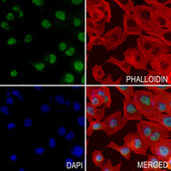 SKP1 Rabbit Monoclonal Antibody