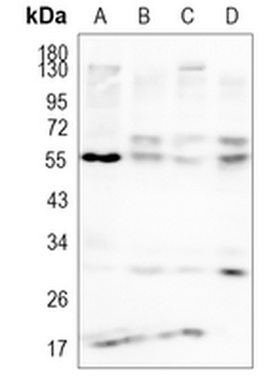 LCAT Rabbit Monoclonal Antibody