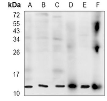 FDX1 Rabbit Monoclonal Antibody