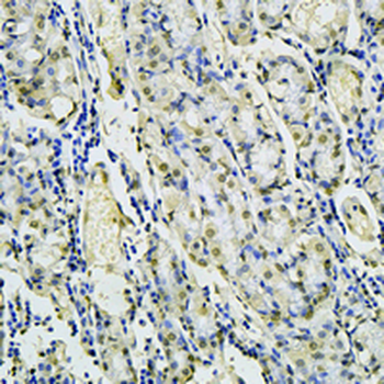RSK2 Rabbit Monoclonal Antibody