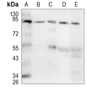 CDT2 Rabbit Monoclonal Antibody