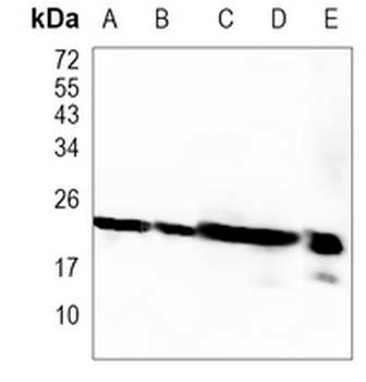 GSTP1 Rabbit Monoclonal Antibody
