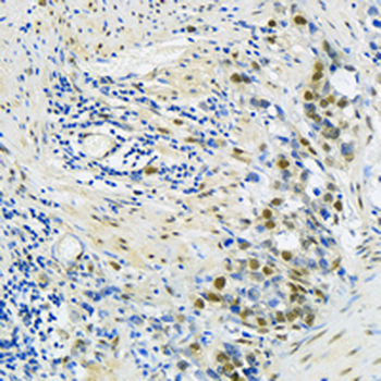 KLF4 Rabbit Monoclonal Antibody