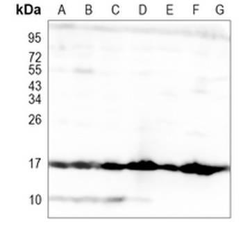 VAMP2 Rabbit Monoclonal Antibody