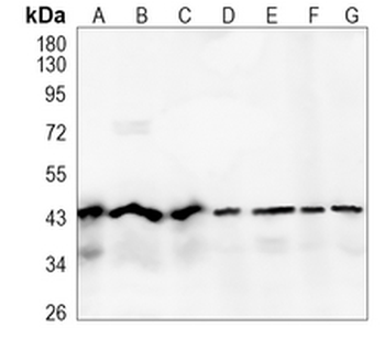 TARDBP Rabbit Monoclonal Antibody