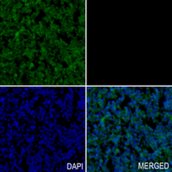 SMAD2 Rabbit Monoclonal Antibody