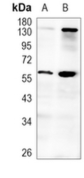SCP2 Rabbit Monoclonal Antibody
