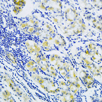MRPS15 Rabbit Monoclonal Antibody