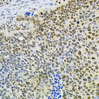 FUBP1 Rabbit Monoclonal Antibody
