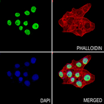 FUBP1 Rabbit Monoclonal Antibody