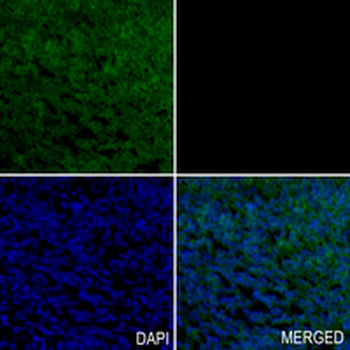 PTBP2 Rabbit Monoclonal Antibody