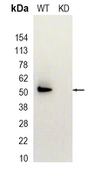 GRSF1 Rabbit Monoclonal Antibody