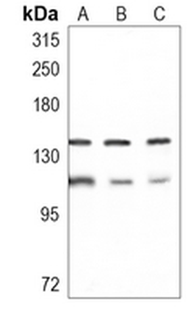 PHF8 Rabbit Monoclonal Antibody
