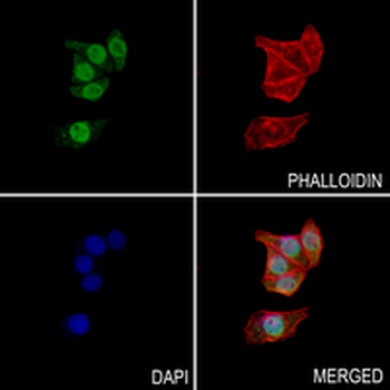 PKN2 Rabbit Monoclonal Antibody