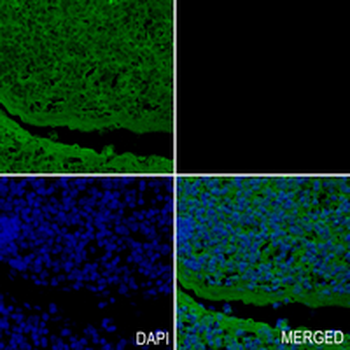 NR5A1 Rabbit Monoclonal Antibody