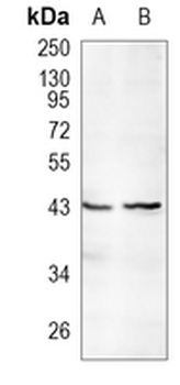 TAPP1 Rabbit Monoclonal Antibody