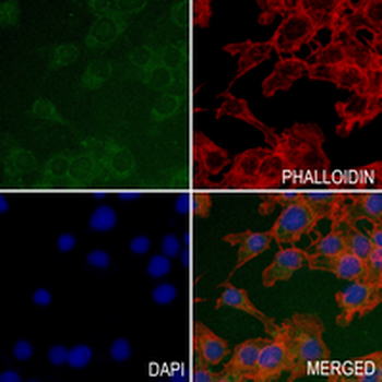 TAPP1 Rabbit Monoclonal Antibody
