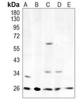 MTAP Rabbit Monoclonal Antibody