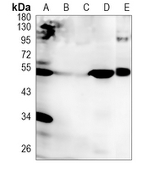 VSX2 Rabbit Monoclonal Antibody