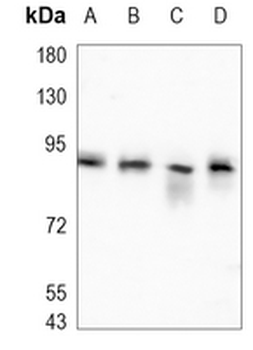 Beta-catenin Rabbit Monoclonal Antibody