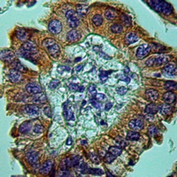 Beta-catenin Rabbit Monoclonal Antibody