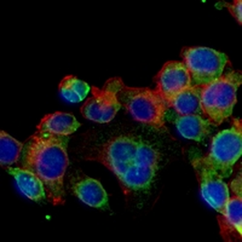 Beta-catenin Rabbit Monoclonal Antibody