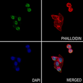 SNRPA1 Rabbit Monoclonal Antibody