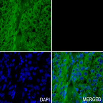 p115 Rabbit Monoclonal Antibody