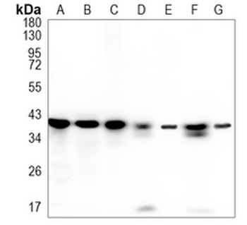 STOML2 Rabbit Monoclonal Antibody