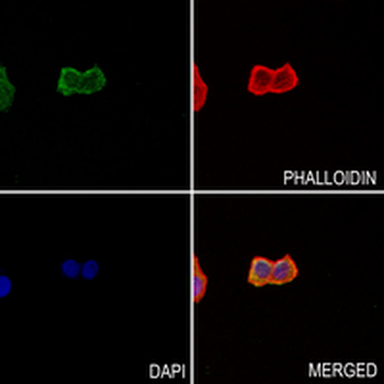 Paxillin Rabbit Monoclonal Antibody