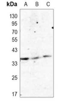C3orf38 Rabbit Monoclonal Antibody