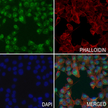 SOX10 Rabbit Monoclonal Antibody