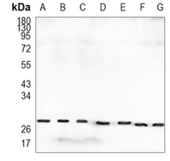 HSP27 Rabbit Monoclonal Antibody