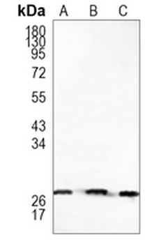 HSP27 (Phospho-S82) Rabbit Monoclonal Antibody
