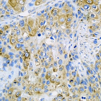 PDI Rabbit Monoclonal Antibody