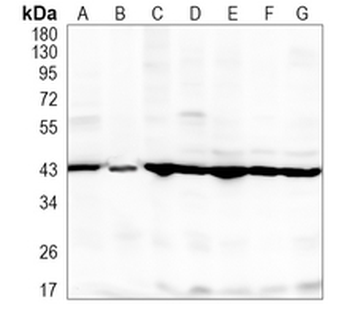 GOT2 Rabbit Monoclonal Antibody