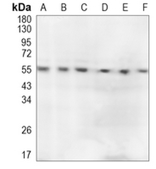 STAU1 Rabbit Monoclonal Antibody