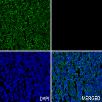 STAU1 Rabbit Monoclonal Antibody